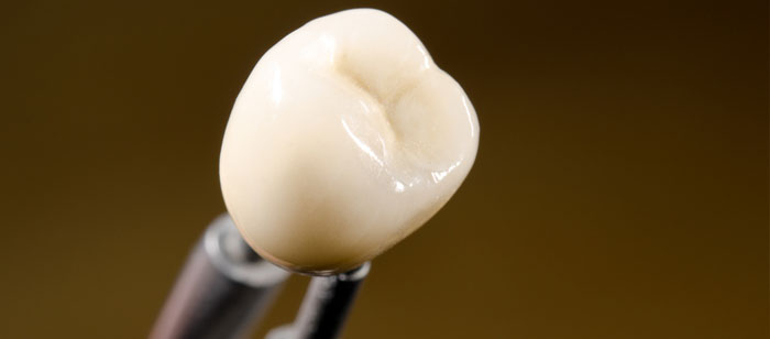 Dental Crowns